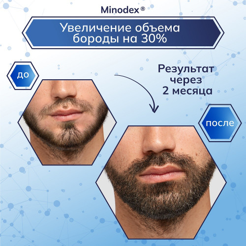 миноксидил, средство от облысения